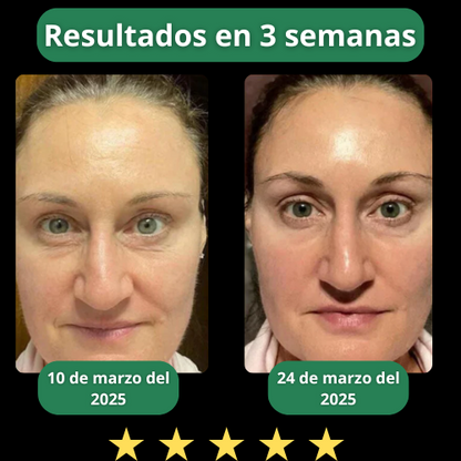 PARCHES DE COLÁGENO DEL 2025